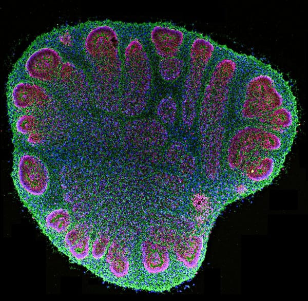 Pea-size human brain organoids spark hope and ethical concern — Npr.brightspotcdn.com