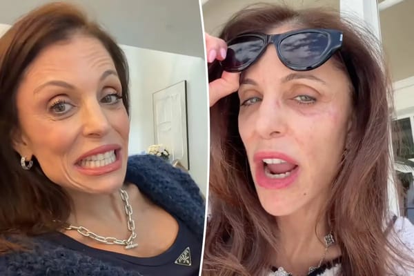Bethenny Frankel blames St. Barts hotel towels for facial bacterial infection — Pagesix.com