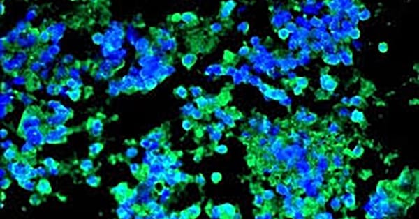 Experimental antibody GT103 shows early signs of activity in lung cancer — Static01.nyt.com