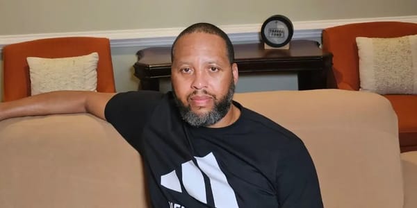 I'm a grandfather and had lower eyelid surgery to be more confident — Businessinsider