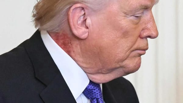 Red rash appears on President Trump’s neck at White House ceremony — Kotaku
