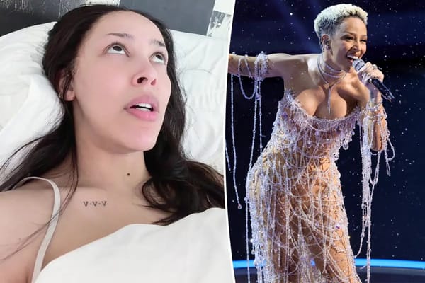 Doja Cat says she's 'struggling' with borderline personality disorder — Pagesix