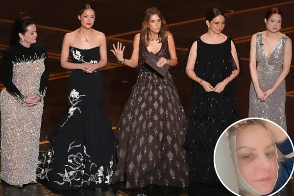 Wendi McLendon-Covey skips Oscars reunion after neck lift — Pagesix